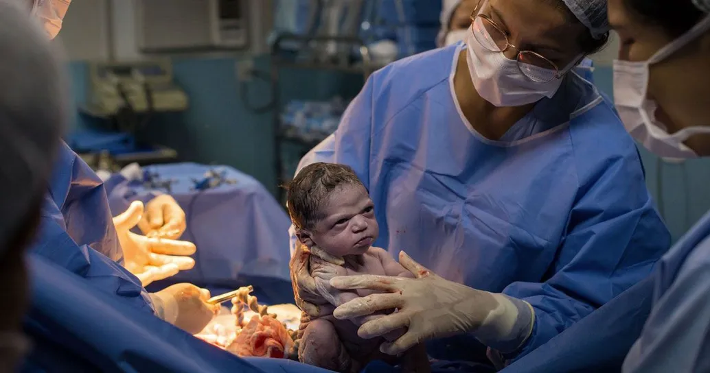 Appena nata è già arrabbiata con il medico: le foto fanno il giro del mondo