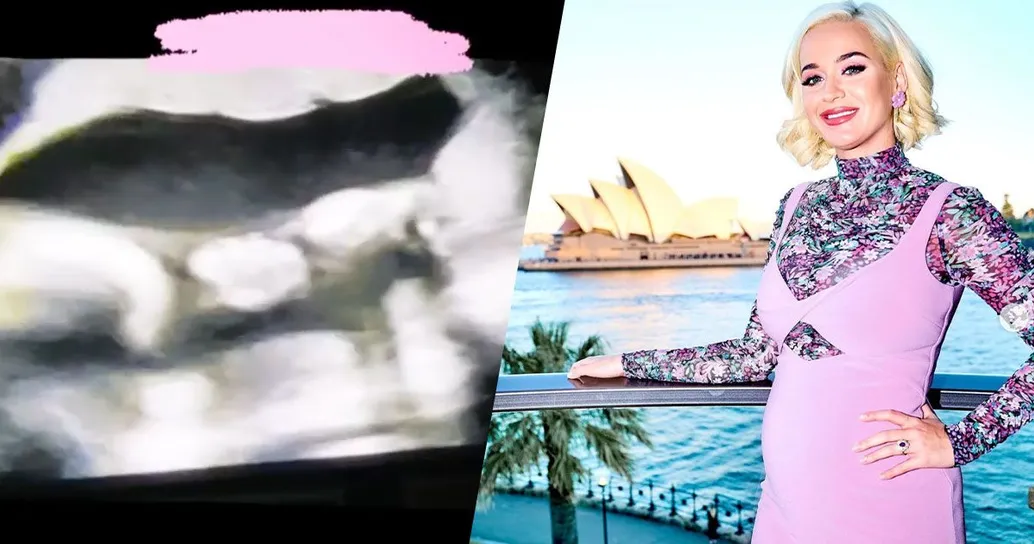 Katy Perry mostra il video della sua ecografia: “Mia figlia mi ha fatto il dito medio”