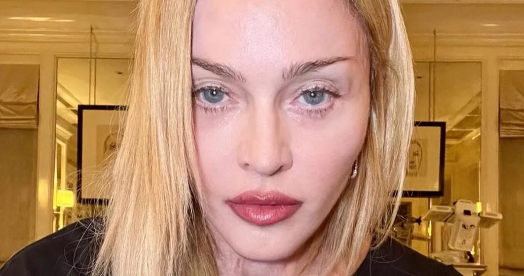 Madonna riappare sui social dopo il ricovero: la lettera per i fan