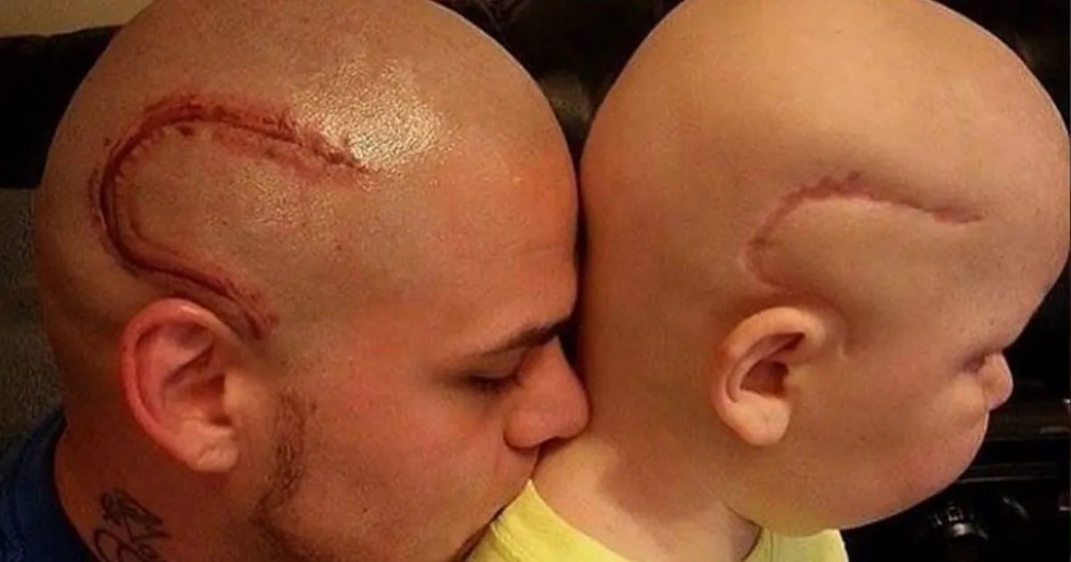 Si tatua la stessa cicatrice del figlio