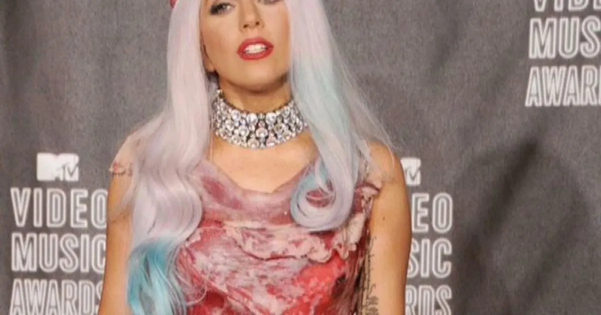 Rivelazione shock di Lady Gaga soffro di una malattia mentale