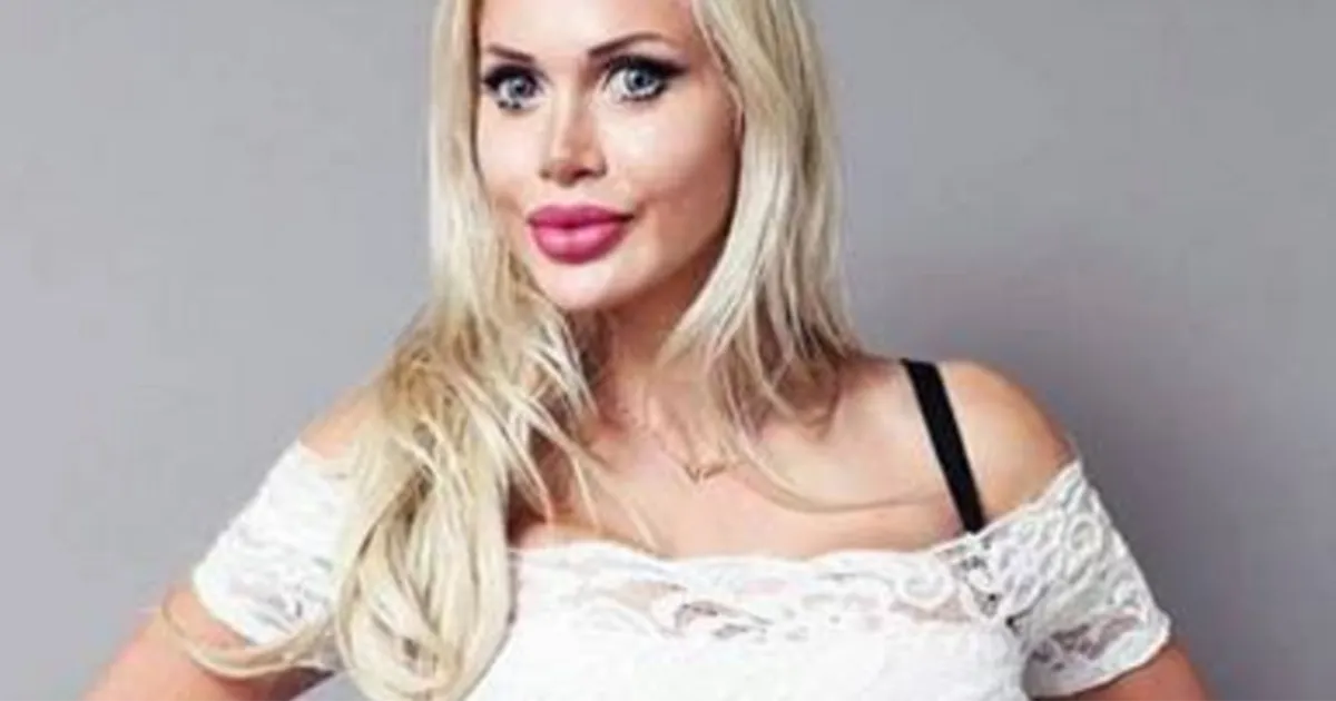Per somigliare a Jessica Rabbit si fa togliere sei costole Il risultato8230