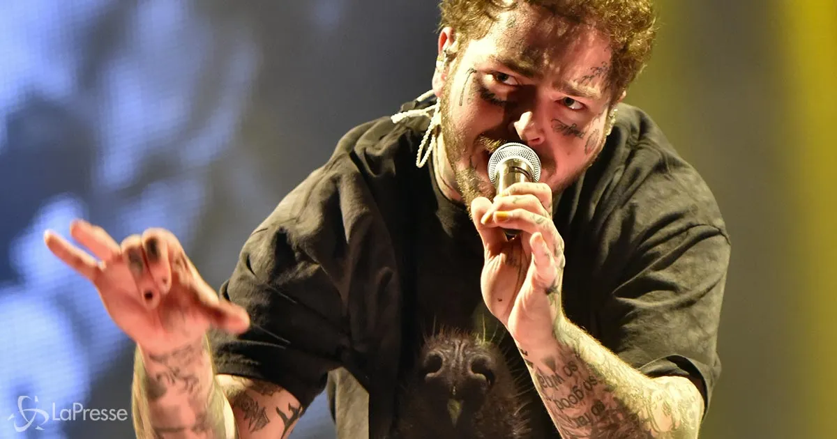 Post Malone e suoi i denti da 1600000 dollari la foto