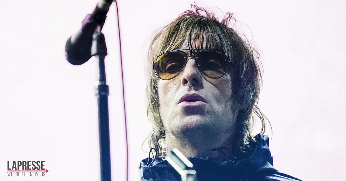 Liam Gallagher cade dall8217elicottero e si ferisce il volto la foto condivisa per i fan