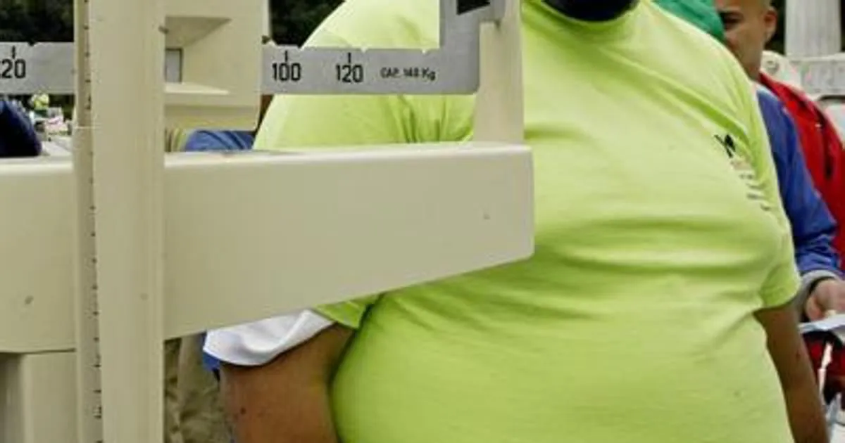 Altro che dottor Nowzaradan contro l8217obesit l8217innovazione parla italiano