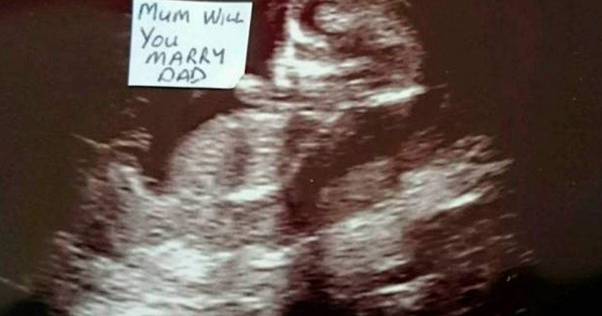 Le chiede 148 volte la mano: e dopo 5 mesi lei se ne accorge.