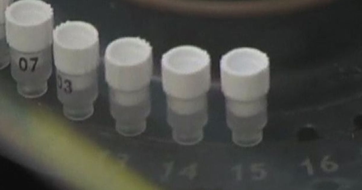 Paura in Usa per un batterio che resiste a tutti gli antibiotici