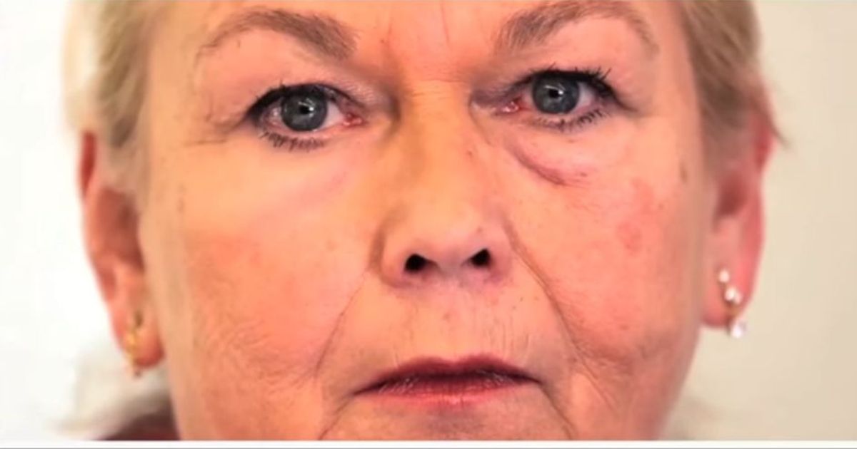 Second Skin, pelle giovane una seconda volta