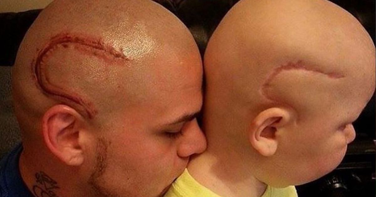 Si tatua la stessa cicatrice del figlio