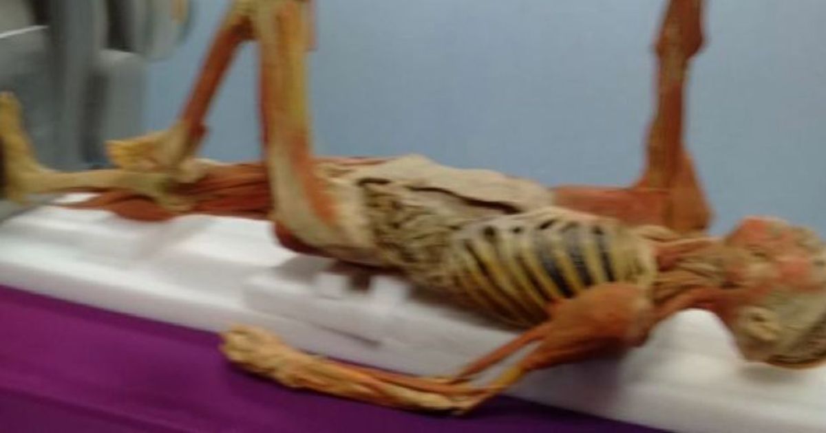 Una mummia di “Real Bodies” operata a Milano