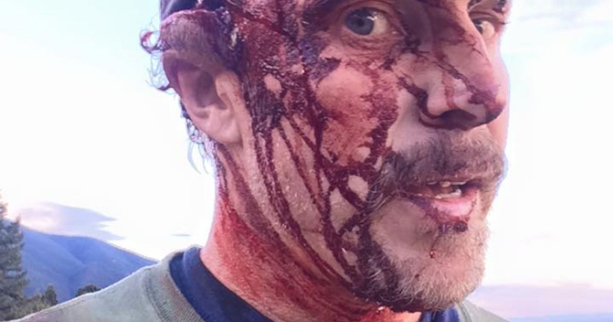 Grizzly attacca Todd Orr come Di Caprio