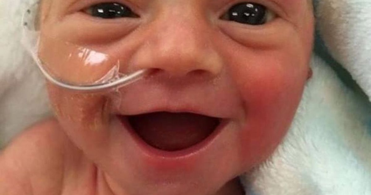 Il meraviglioso sorriso di questa bambina nata prematura conquista il web