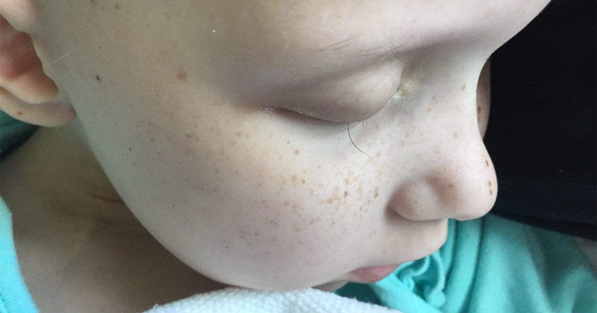 Una foto ci mostra gli effetti del tumore sui bambini