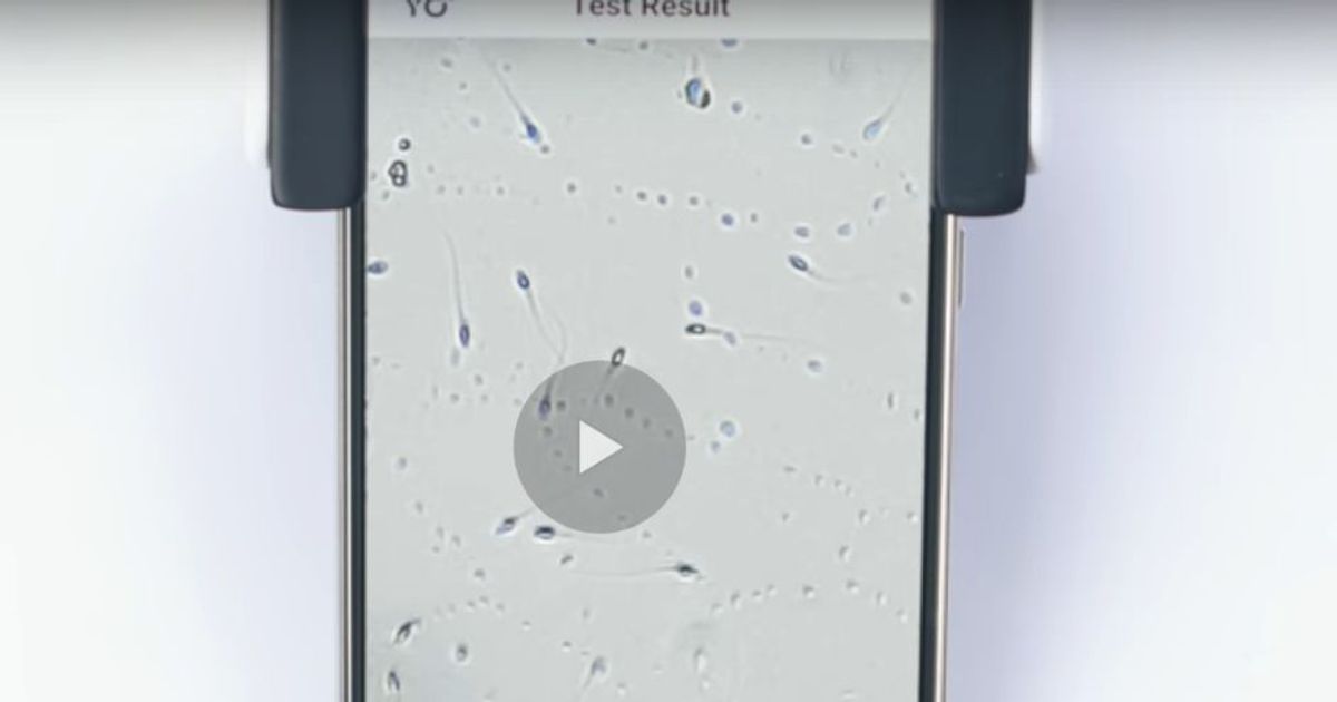 Yo Sperm Test la App che analizza la vostra fertilità