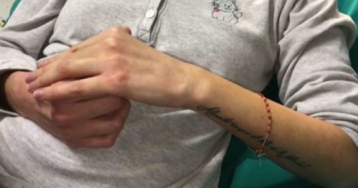 Video su facebook di Gessica Notaro, sfregiata con acido dall’ex