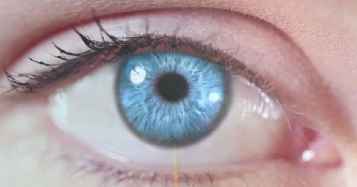 Lo spot con Ricky Tognazzi per la prevenzione del glaucoma
