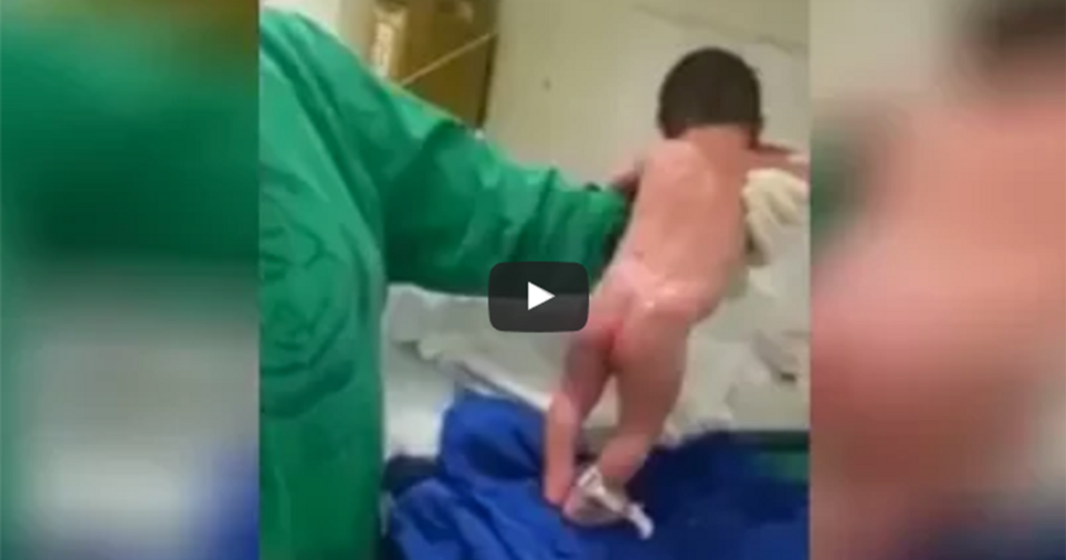 La bambina è appena nata: l’infermiera la vuole lavare ma inizia subito a camminare