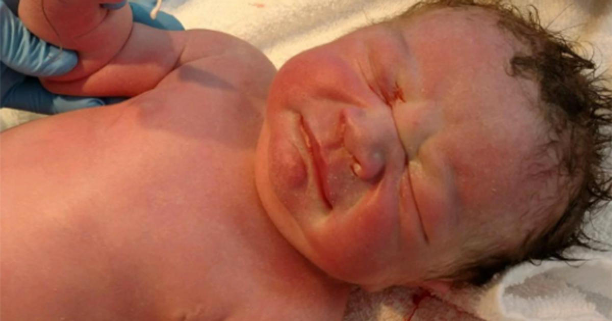 Il bambino viene al mondo con in mano il contraccettivo della mamma