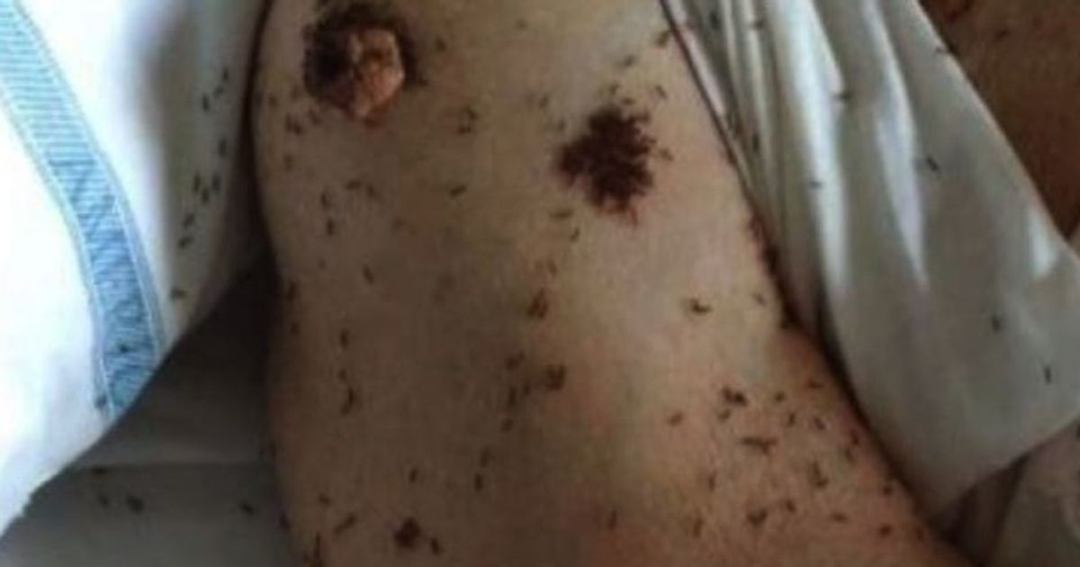 Formiche in ospedale a Napoli, Borrelli: cacciare i responsabili