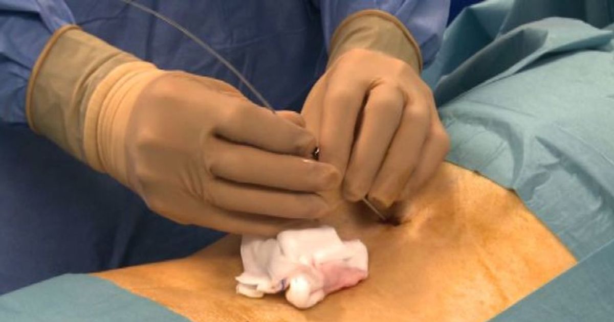 Iccs: terapia del dolore, risposta a un bisogno concreto