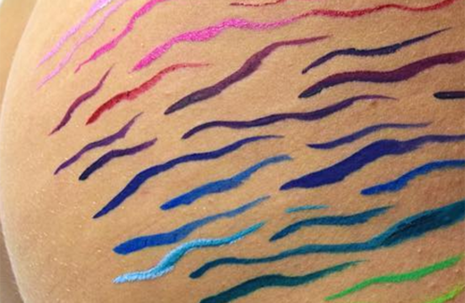 Le smagliature diventano opere d’arte: questa è la sfida di un’artista di 21 anni