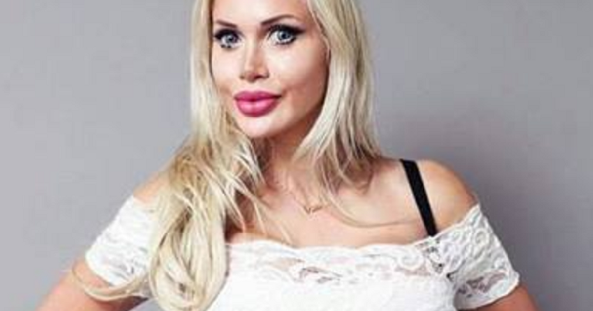 Per somigliare a Jessica Rabbit si fa togliere sei costole. Il risultato…