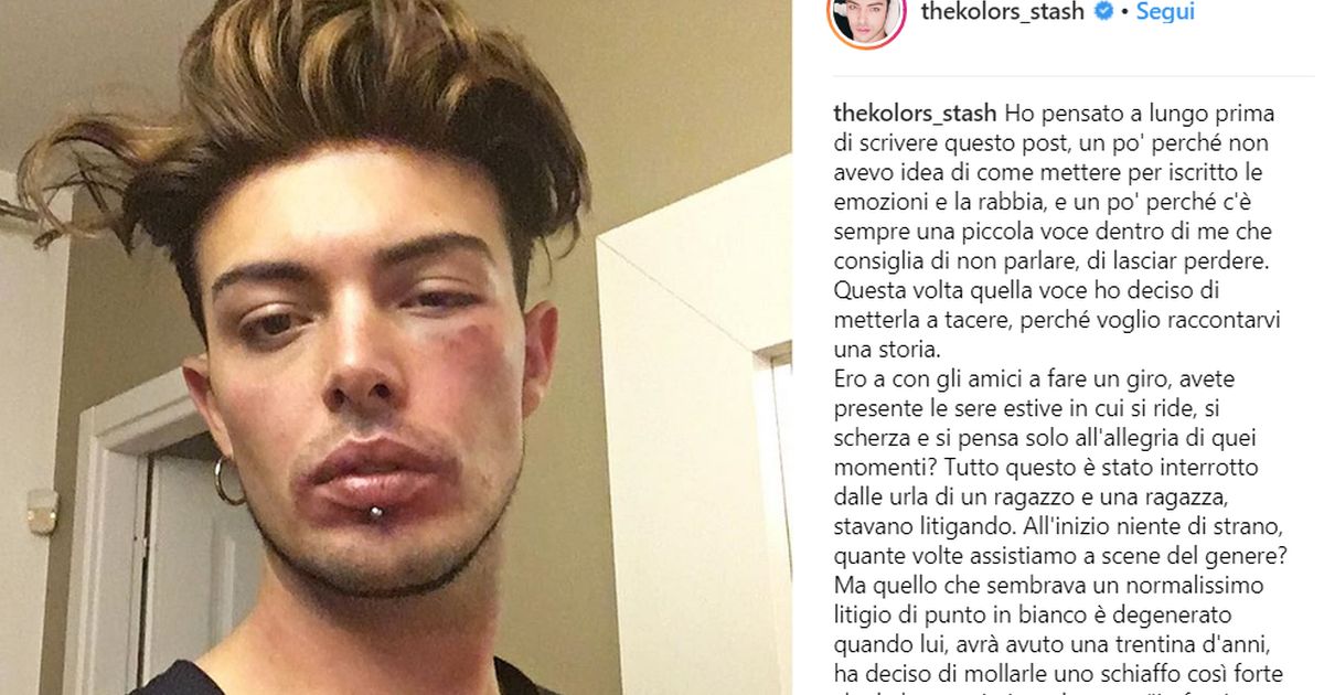 Stash dei The Kolors: in una rissa per difendere una donna