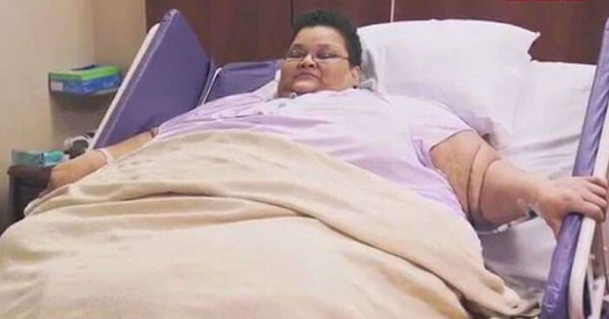 Perde 270 kg e torna a camminare: ecco come è oggi