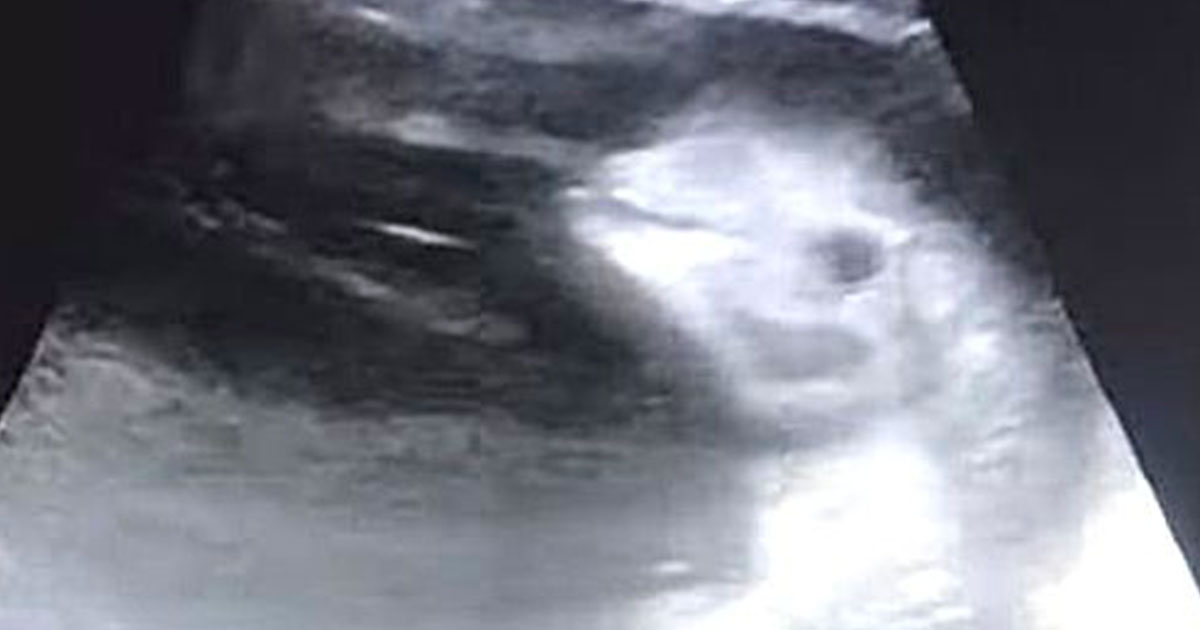 Avete mai visto l’ecografia di un cucciolo di beluga? E’ semplicemente bellissima