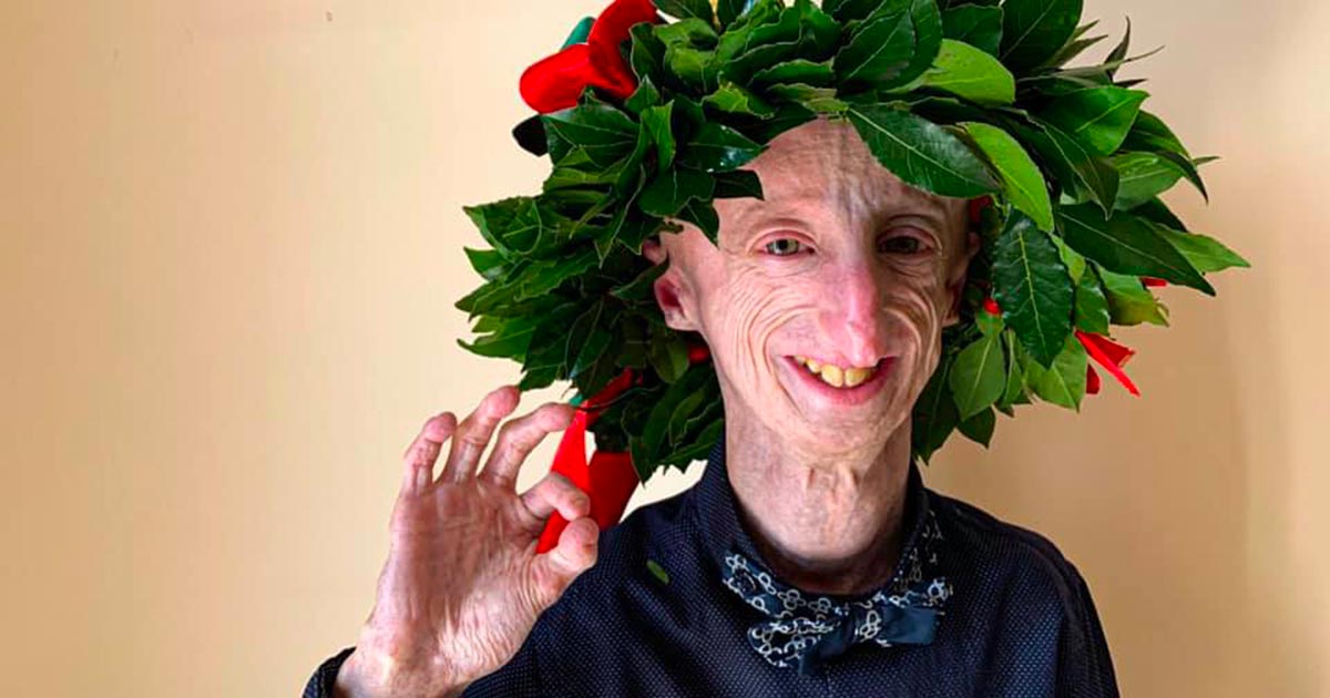 Seconda laurea per Sammy Basso, ora è dottore in Molecular Biology